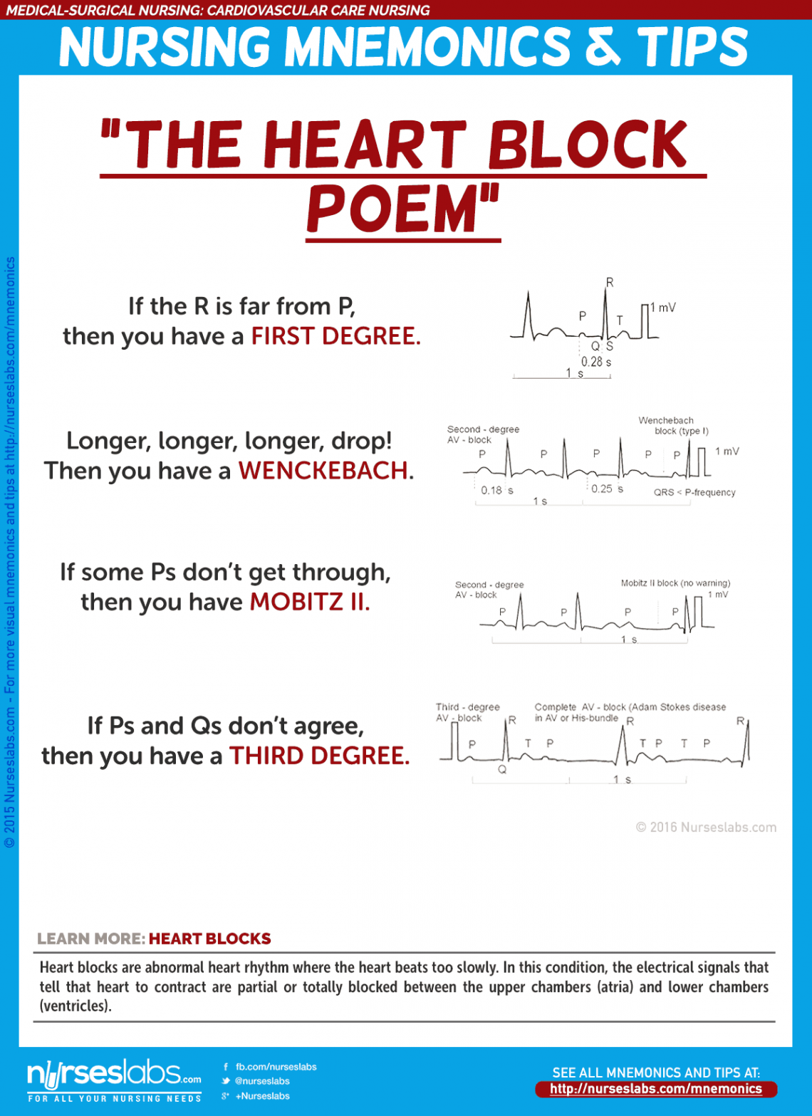 Cardiovascular Care Nursing Mnemonics and Tips - Nurseslabs