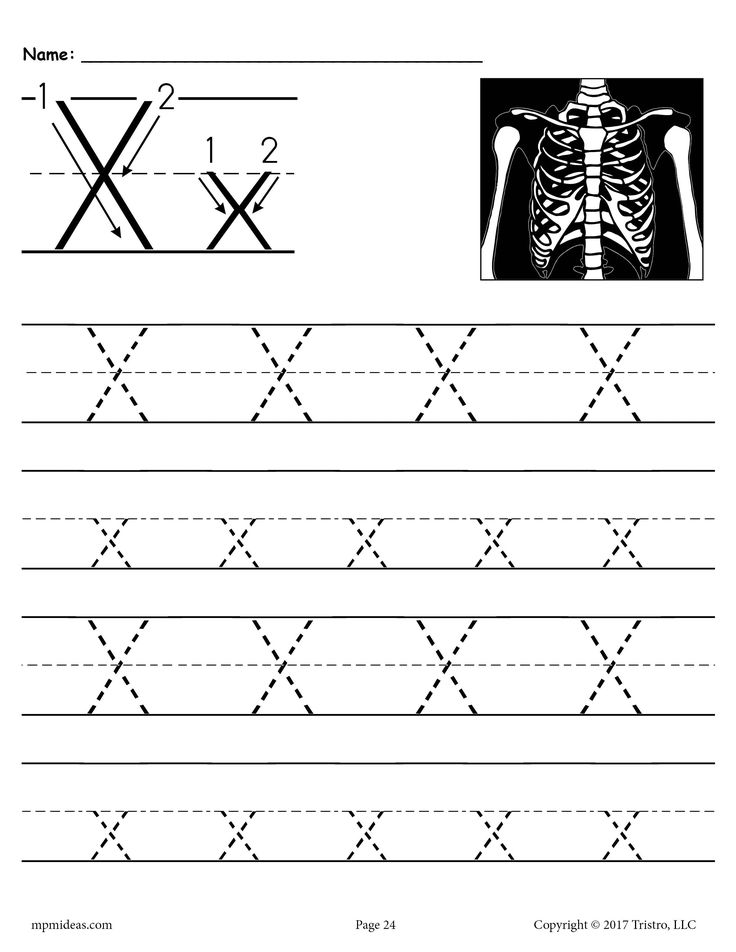 85 Solve For X Worksheet 45